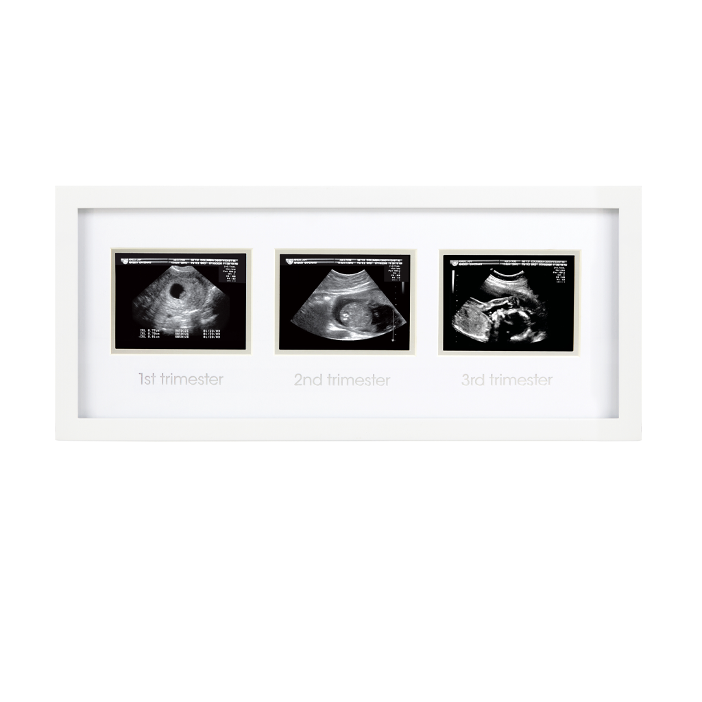 trimester sonogram frame