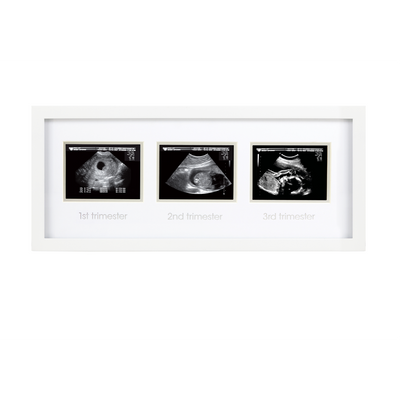 trimester sonogram frame