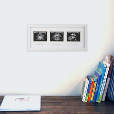 trimester sonogram frame